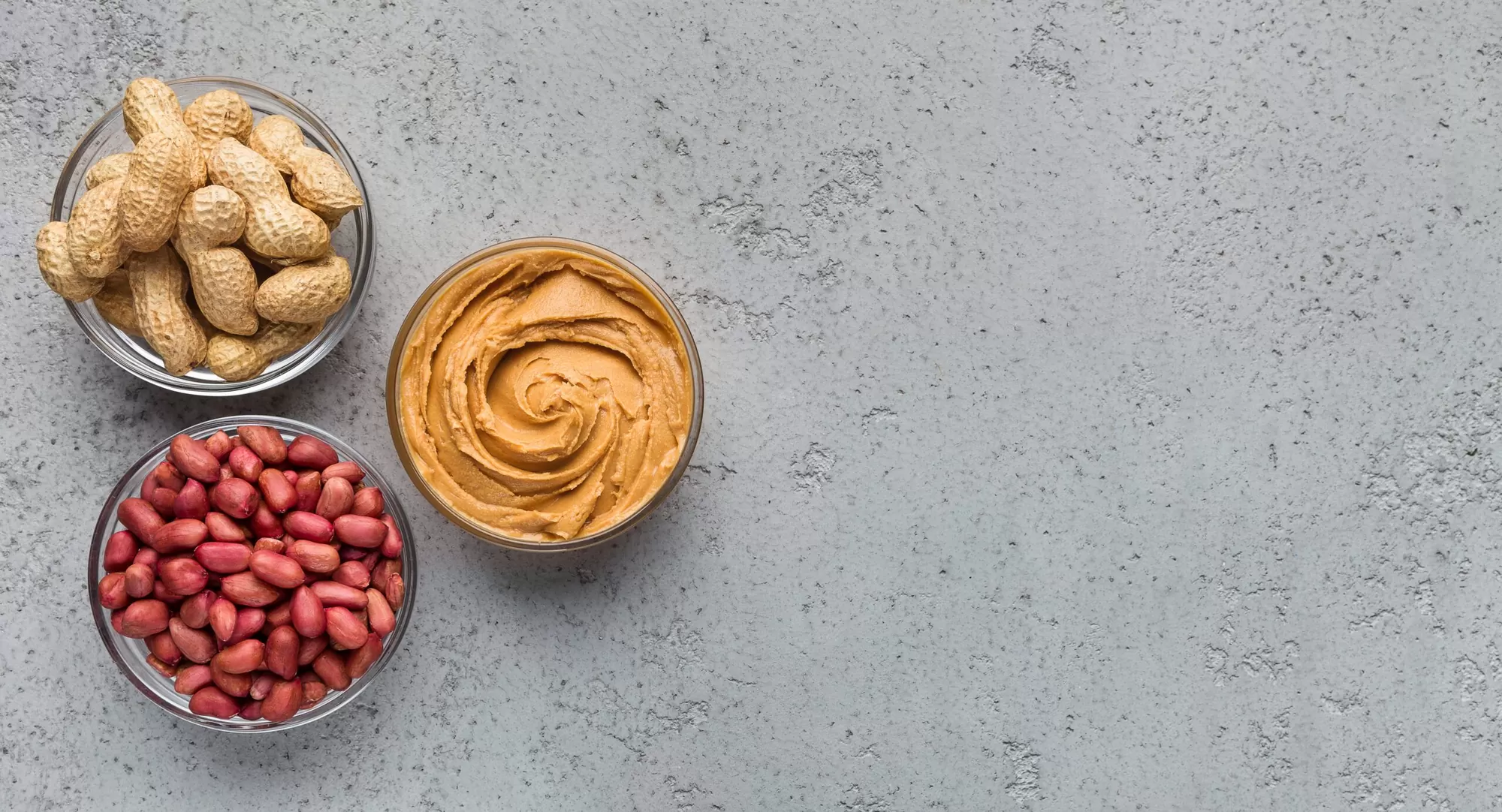Peanut Allergy Management for All Ages: Prevention, Safety, and Emergency Response