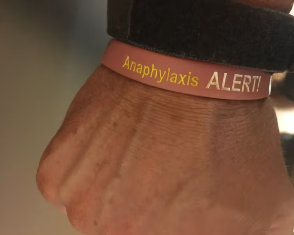 Bee sting allergy awareness bracelet for children with allergic rhinitis